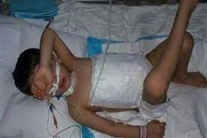 کودکی که شکمش توسط گرگ دریده شده بود، درگذشت