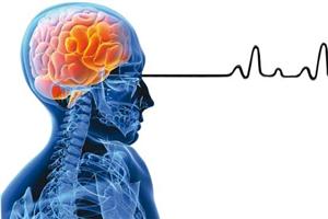 3 ساعت حیاتی برای نجات بیماران سکته مغزی