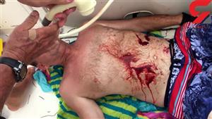 تصاویری وحشتناک از حمله کوسه به یک مرد + عکس (14+) 