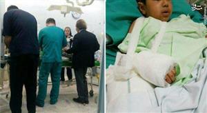 پیوند دست کودک سرپل ذهابی در عمل جراحی نادر/عکس