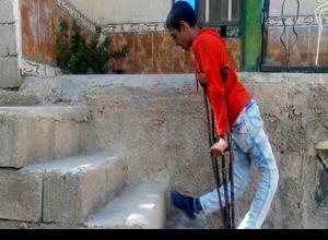 معلولیت نادر گربانگیر این پسر ایرانی شد