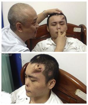 مردی که بینی اش روی پیشانی اش است+عکس