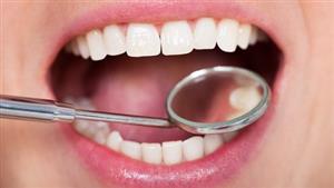 ارتباط بهداشت دندان‌ها با قندخون در دیابتی ها
