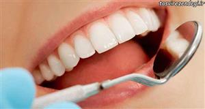 رسیدن شاخص پوسیدگی دندان از ۲.۹ به ۱.۸۴
