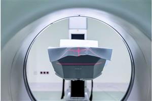 ابزار هوش مصنوعی برای درمان سرطان پروستات